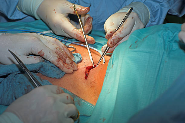 surgeons suture a neck wound after thyroid surgery.